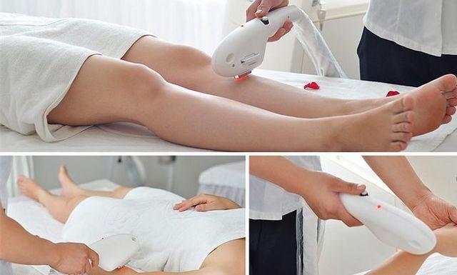 Chị em vẫn đang thắc mắc: Liệu triệt lông vĩnh viễn có tốt hay không? - 1