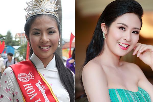 Thủy Tiên, Hồng Nhung chứng minh: niềng răng amp;#34;thăng hạngamp;#34; nhan sắc là có thật! - 5