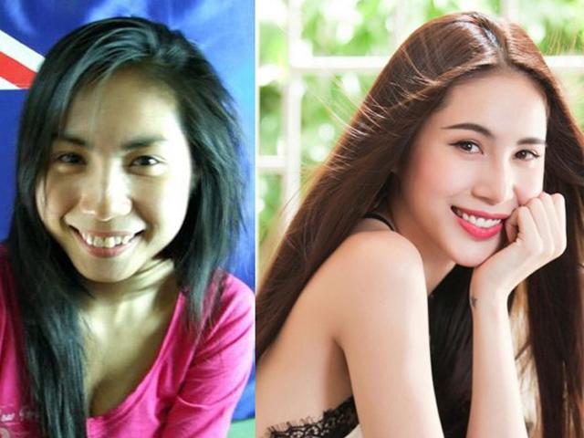 Thủy Tiên, Hồng Nhung chứng minh: niềng răng thăng hạng nhan sắc là có thật!