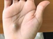 Sức khỏe - Lười vệ sinh răng miệng, thanh niên không ngờ mắc trọng bệnh chỉ từ khối u nhỏ