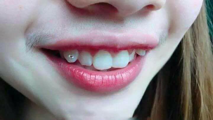 Hỡi những cô nàng đang bị chê vì amp;#34;khoe môi, lộ luôn ria mépamp;#34;, hãy đọc ngay bài viết này! - 1