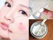 Làm đẹp - Bất ngờ trước cách trị mụn bọc chẳng tốn bao nhiêu tiền với kem đánh răng!