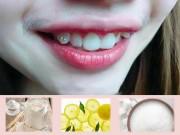Làm đẹp - Hỡi những cô nàng đang bị chê vì "khoe môi, lộ luôn ria mép", hãy đọc ngay bài viết này!
