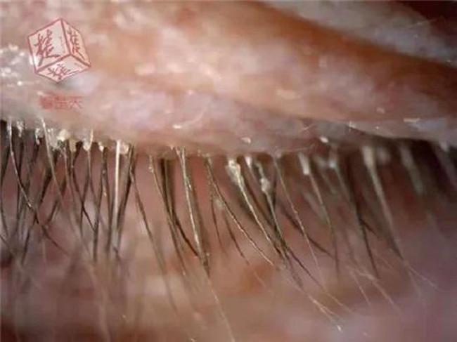 20 năm không đánh răng, chục năm không tắm,... cuối cùng những người này phải lĩnh hậu quả - 2