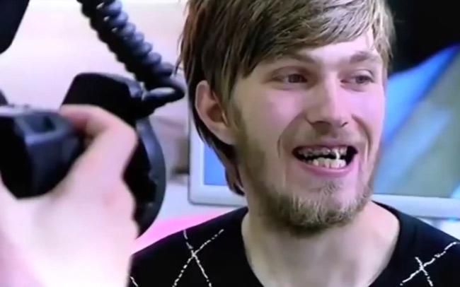 20 năm không đánh răng, chục năm không tắm,... cuối cùng những người này phải lĩnh hậu quả - 3