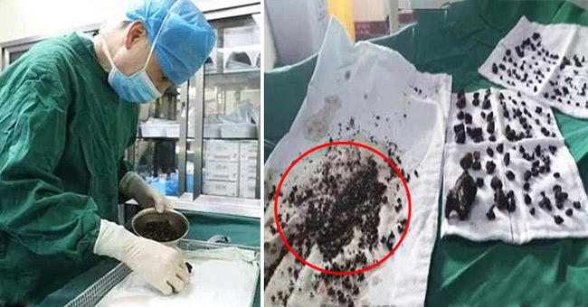 20 năm không đánh răng, chục năm không tắm,... cuối cùng những người này phải lĩnh hậu quả - 4