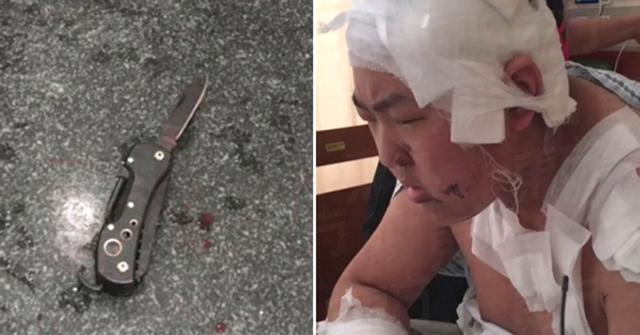 Nam sinh đâm bạn cùng phòng thừa sống thiếu chết chỉ vì bị phàn nàn ngủ ngáy và xì hơi - 2