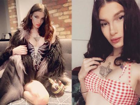 Éo le chàng trai chuyển giới xong thì phát hiện mình vẫn thích phụ nữ