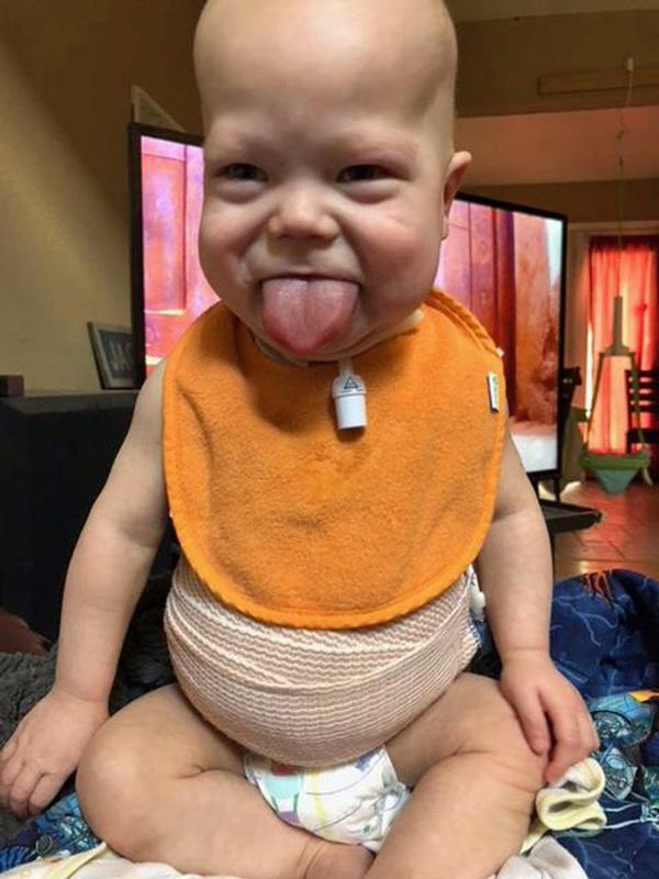 Hào hứng khen bé lè lưỡi đáng yêu khi siêu âm, ngày sinh ra mẹ thẫn thờ nhìn mặt con - 2