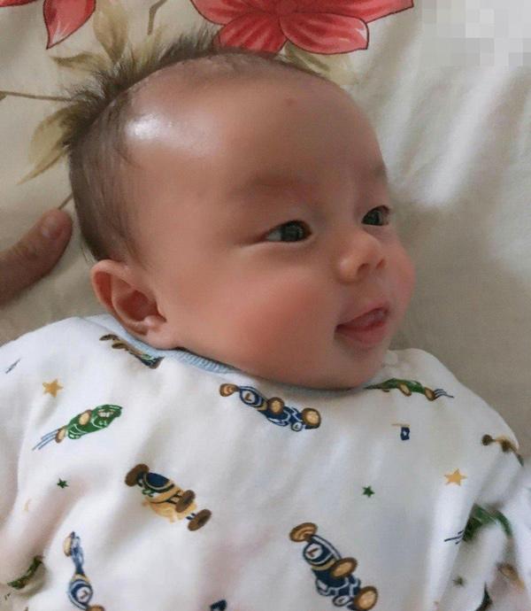 Tưởng chỉ bị tắc sữa, mẹ Bình Dương nuốt nước mắt đành cắt cụt tứ chi để được sống - 4