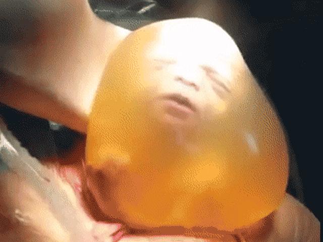 Bác sĩ mổ xong vẫn chưa được ra ngoài, em bé ngọ nguậy hết sức để thoát khỏi túi ối