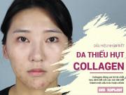 Làm đẹp - Da thiếu hụt Collagen - đâu là dấu hiệu nhận biết?