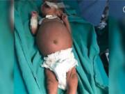 Tin tức - Bé gái sơ sinh bụng sưng phồng đau dữ dội, gia đình tá hỏa phát hiện một 'em bé' nữa