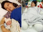 Bà bầu - Mẹ Bình Dương cắt cụt tứ chi do tắc sữa: Quy tắc phòng bệnh mẹ cho con bú phải biết!