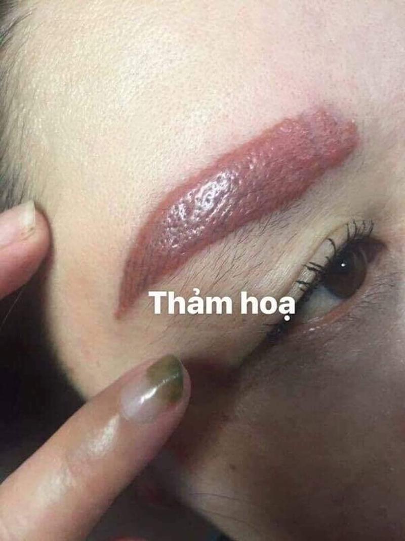 Thật sự là thảm họa, tiền thì mất, tật thì mang.
