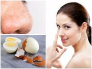 Làm đẹp - Cách trị mụn đầu đen tận gốc trả lại làn da vẻ trắng mịn tự nhiên