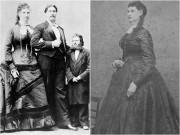 Sức khỏe - Có 'cô bé' rộng nhất thế giới, người phụ nữ được tung hô, Nữ hoàng tặng cả váy cưới