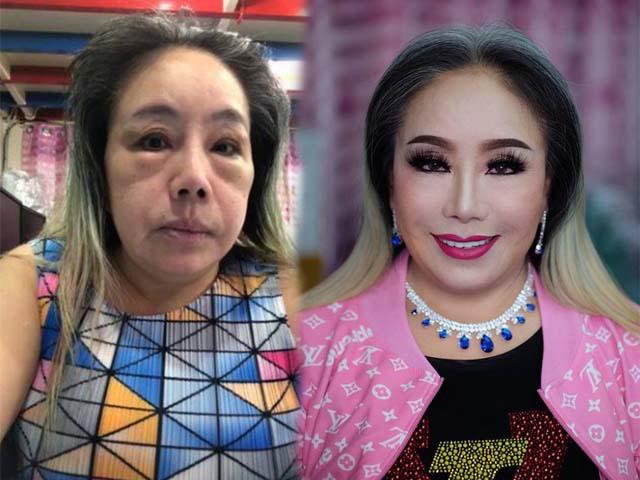 Sau nhiều cuộc trùng tu, nhan sắc của đại gia 60 tuổi 14 đời chồng khiến nhiều người… bật ngửa