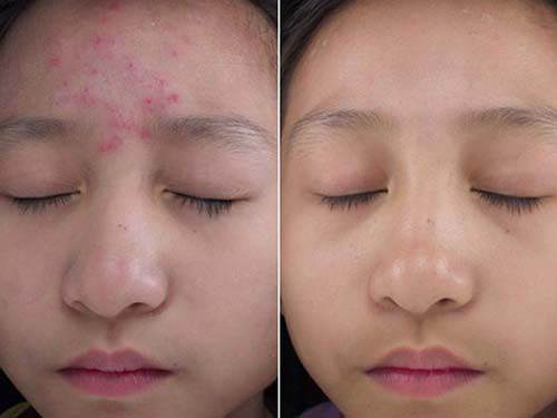 Kể không hết công dụng làm đẹp của lọ phấn rôm giá hơn 20 ngàn, ai không biết thật uổng! - 2