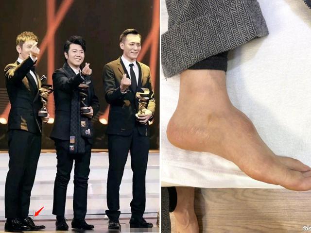 Lần đầu Huỳnh Hiểu Minh được minh oan, xót xa nguyên nhân thực sự nam tài tử đi giày độn