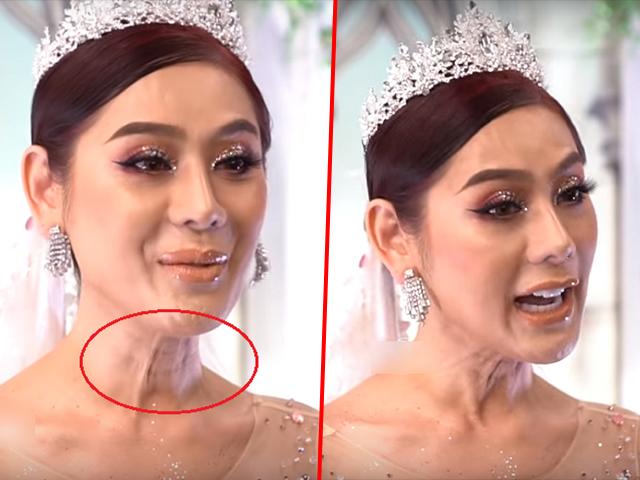 Hết da đen sạm, mặt đầy nếp nhăn, Lâm Khánh Chi lại gây choáng với vùng cổ chảy xệ