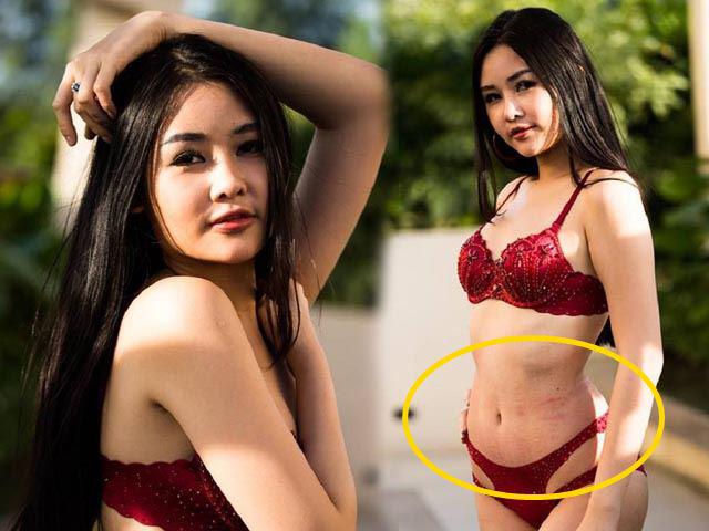 Chụp ảnh áo tắm nhưng chưa photoshop, Ngân Anh lộ vùng da xù xì, ửng đỏ ngay chỗ nhạy cảm