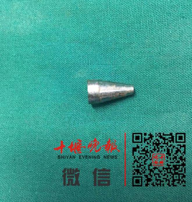 Bé gái 8 tuổi suýt mất mạng vì một thói quen mỗi khi ngồi vào bàn học - 3