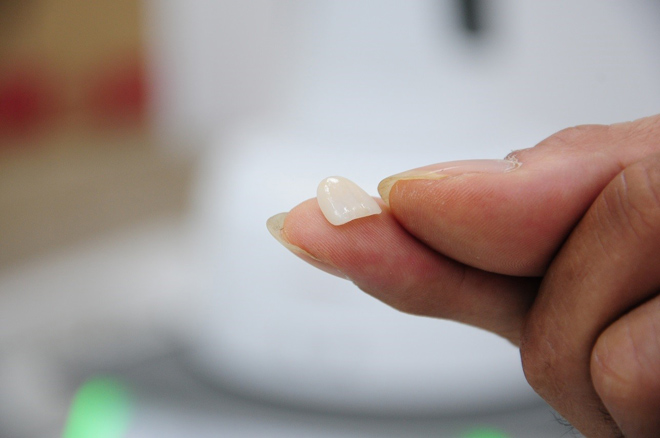 Đón Tết tự tin hơn với hàm răng trắng đẹp - 5