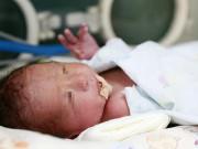 Bà bầu - Con gái bẩm sinh không có 'vùng kín', mẹ làm việc bất ngờ để con mang thai