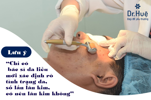 lieu trinh lan kim tri mun bao nhieu lan thi da dep? - 2