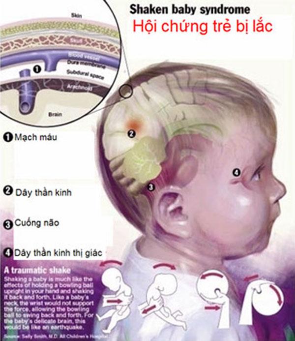 dau long nhung truong hop tre mat mang vi nguoi than rung lac - 6