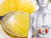 Sức khỏe - Ăn mật ong trước khi đi ngủ bạn sẽ nhận được "hàng tá" lợi ích còn quý hơn vàng