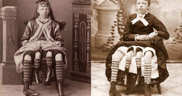 Cô gái kiếm chục triệu mỗi tuần nhờ có 2 chân giữa, khi mang bầu khiến BS ngạc nhiên hơn - 1
