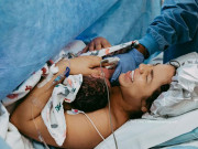 Bà bầu - Chọn ngày giờ tốt cho bé chào đời bằng sinh mổ - hậu quả khó lường