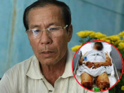 Tin tức - Xót xa tâm sự của người cha khi thấy con trai Việt kiều bị tạt axit, cắt gân chân