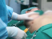 Sức khỏe - Sự thật ung thư sau nâng ngực, BS chỉ rõ đây là những tai biến chị em có thể gặp