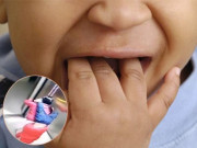 Sức khỏe - Cậu bé thiệt mạng vì hóc đậu phộng, xem camera thang máy, BS chỉ ra sai lầm lớn của mẹ