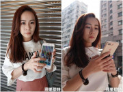 Sức khỏe - Cô gái thủng hơn 500 lỗ trong mắt vì một sai lầm khi dùng điện thoại không ít người mắc