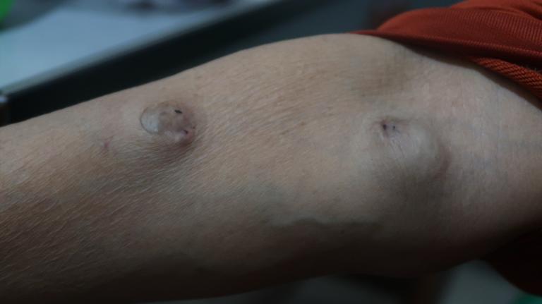 Xót xa cảnh người mẹ co ro ôm hũ hài cốt của con trai vào phòng bệnh để chạy thận - 5