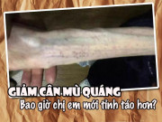 Làm đẹp - Phát hoảng với cánh tay tong teo sau giảm cân, sao chị em cứ không màng hậu quả vậy nhỉ?