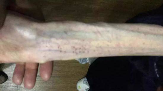 Phát hoảng với cánh tay tong teo sau giảm cân, sao chị em cứ không màng hậu quả vậy nhỉ? - 2