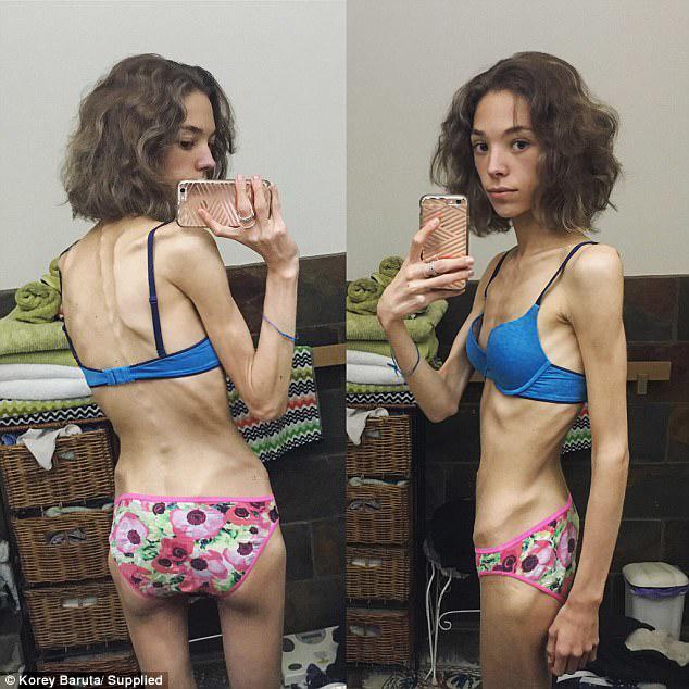 Phát hoảng với cánh tay tong teo sau giảm cân, sao chị em cứ không màng hậu quả vậy nhỉ? - 3