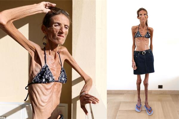 Phát hoảng với cánh tay tong teo sau giảm cân, sao chị em cứ không màng hậu quả vậy nhỉ? - 5