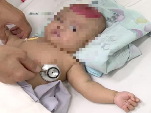 Bất cẩn để điện thoại rơi trúng đầu con, bé gái 2 tháng tuổi bị chấn thương sọ não