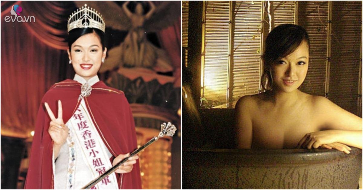 香港最性感選美皇后因醜陋面容被詬病，事業因病毀於一旦。