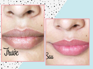 Người ta phun môi tốn cả chục triệu, còn bạn vẫn có môi hồng căng mịn nhờ công thức này