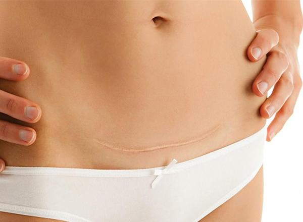 Nằm trong 2 trường hợp nguy hiểm này, mẹ bầu cần khẩn cấp bỏ thai - 2