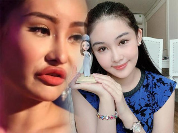 Quên đi thời môi sưng căng phồng, Ngân Anh giờ đây thăng hạng nhan sắc không ngờ