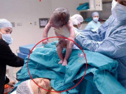 Bà bầu - Vừa lọt lòng đã làm “trò hư đốn", bé sơ sinh khiến cả mẹ và bác sĩ choáng váng