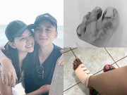 Giải trí - Phan Mạnh Quỳnh và vợ sắp cưới gặp tai nạn giao thông, phải khâu 20 mũi